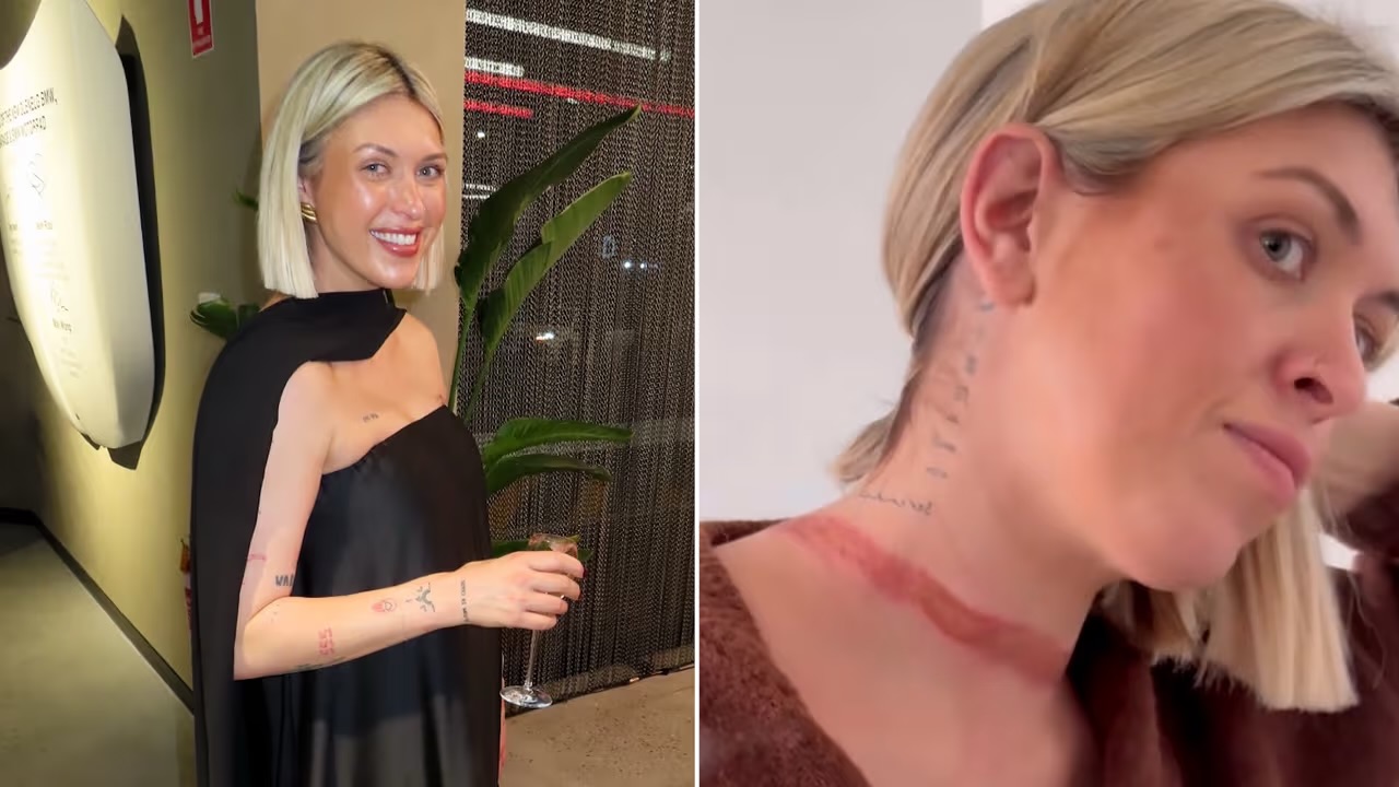 Influencer australiana sufre accidente con su bufanda y lanza advertencia en redes